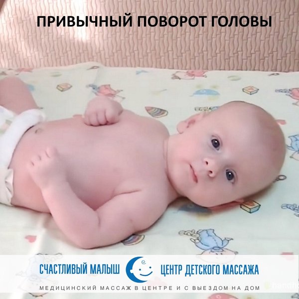 привычный наклон головы. кривошея у взрослых симптомы. взрослые люди с кривошеей. привычный наклон головы у ребенка. кривошея у новорожденных.