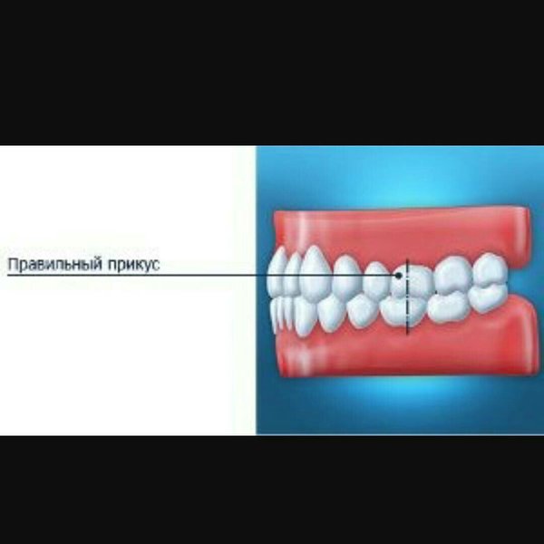 Правильный прикус у человека фото схема как определить