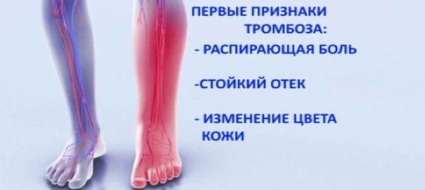Тромбоз конечности карта вызова. Мазь при тромбофлебите нижних конечностей. Доктор вен. Антибиотики при тромбофлебите нижних конечностей