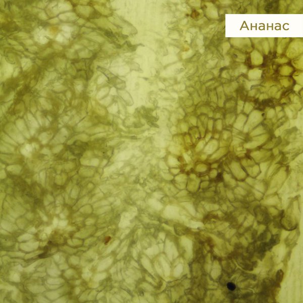 Ginger, SEM - Stock Image - C001/2611 - Science Photo Library