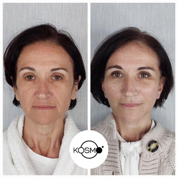 екатеринбург клиника пластической хирургии нудельмана. екб ул московская 19. ковынцев дмитрий николаевич пластический хирург. центр косметологии на московской 19 екатеринбург. ринопластика ковынцев николай николаевич.