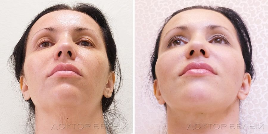 врач и пациент. андреищев малярпластика. пластика шеи и подбородка фото до и после. миома матки фотографии. фото после спейс пластики лица до и после.